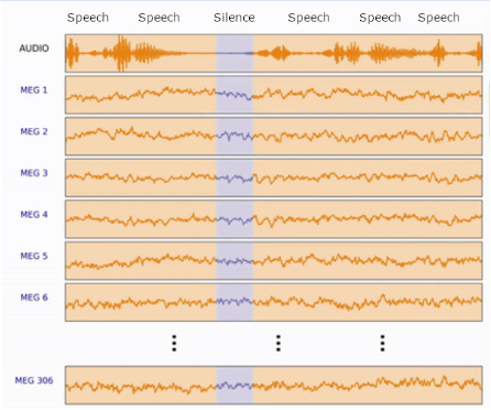 MEG with Speech/Silence labels