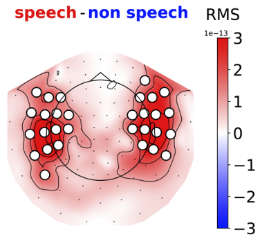 Temporal Areas MEG Sensors are highly indicative of speech segments
